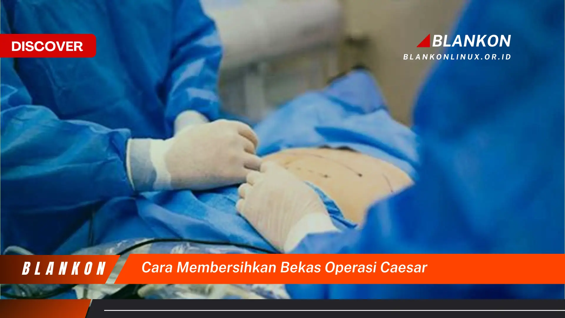 cara membersihkan bekas operasi caesar