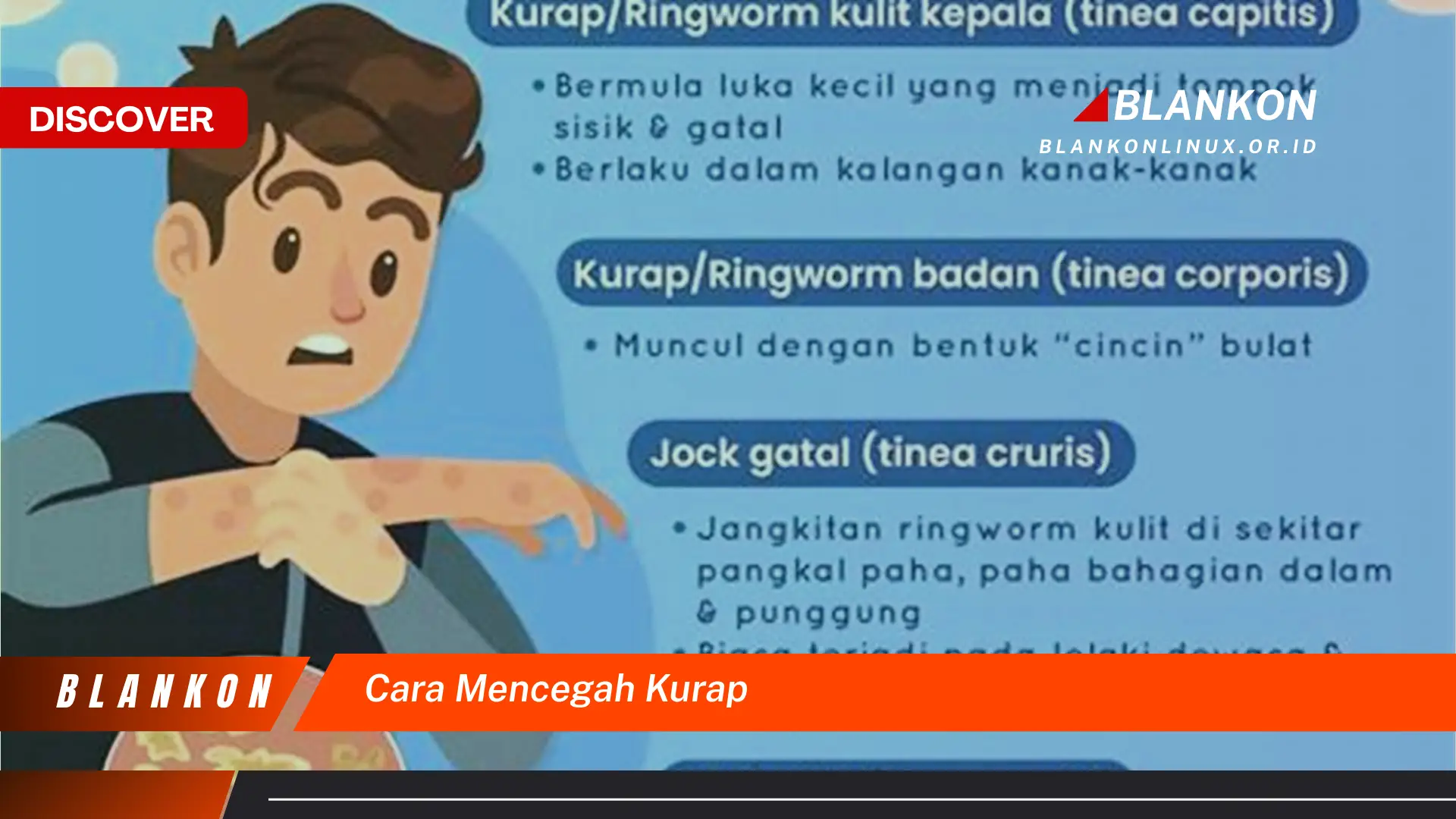 cara mencegah kurap