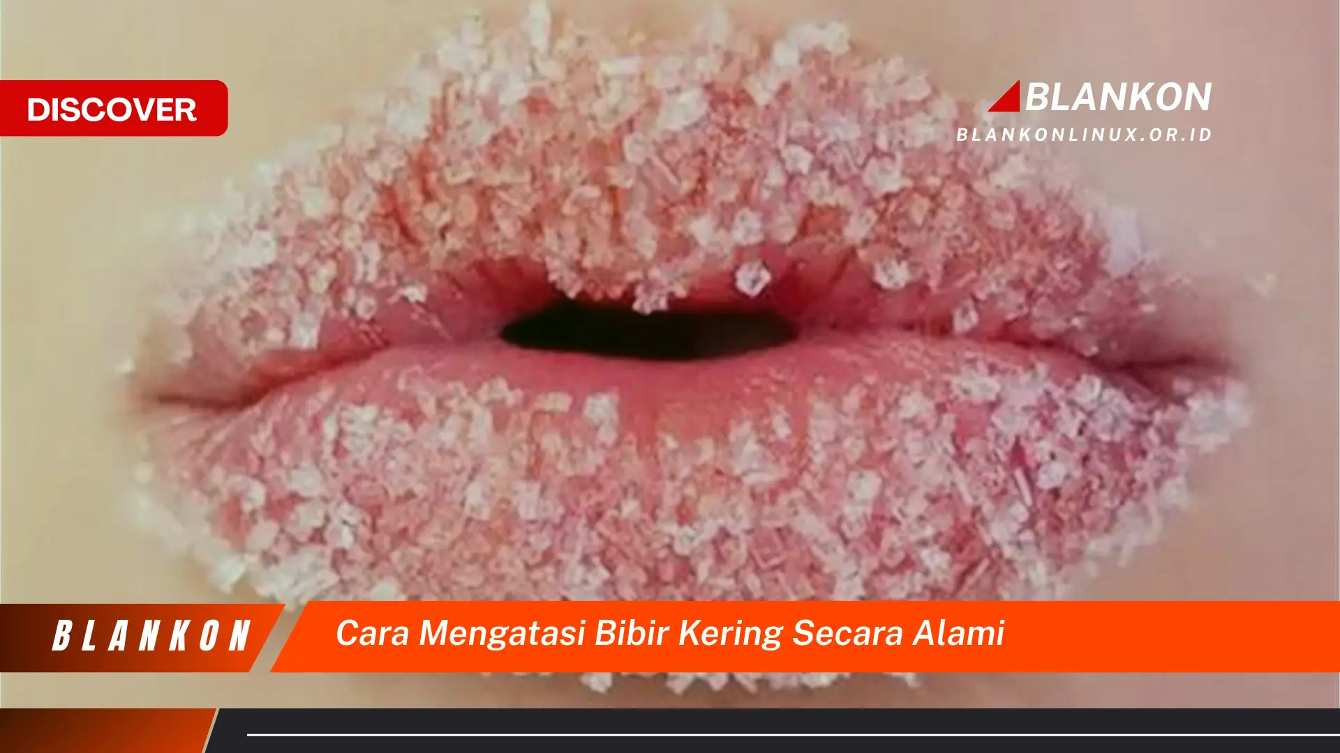 Ketahui Cara Atasi Bibir Kering Secara Alami yang Jarang Diketahui