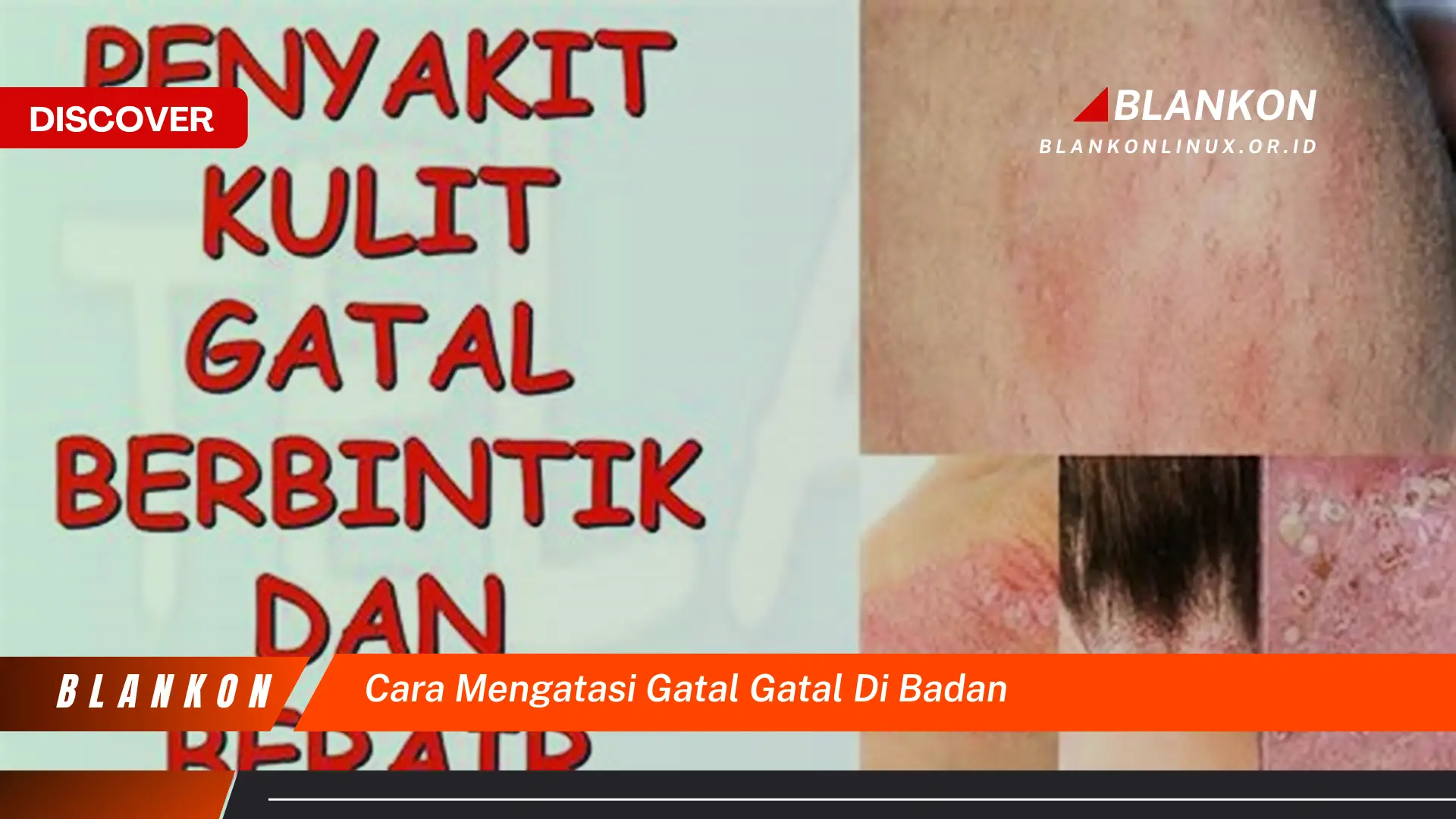 cara mengatasi gatal gatal di badan