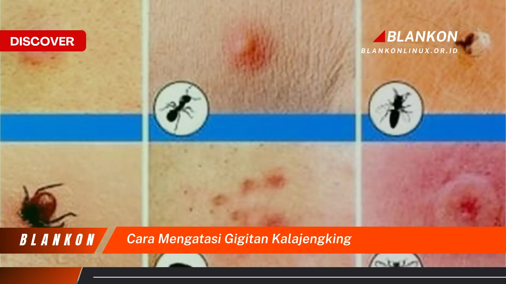 cara mengatasi gigitan kalajengking cara mengatasi gigitan kalajengking