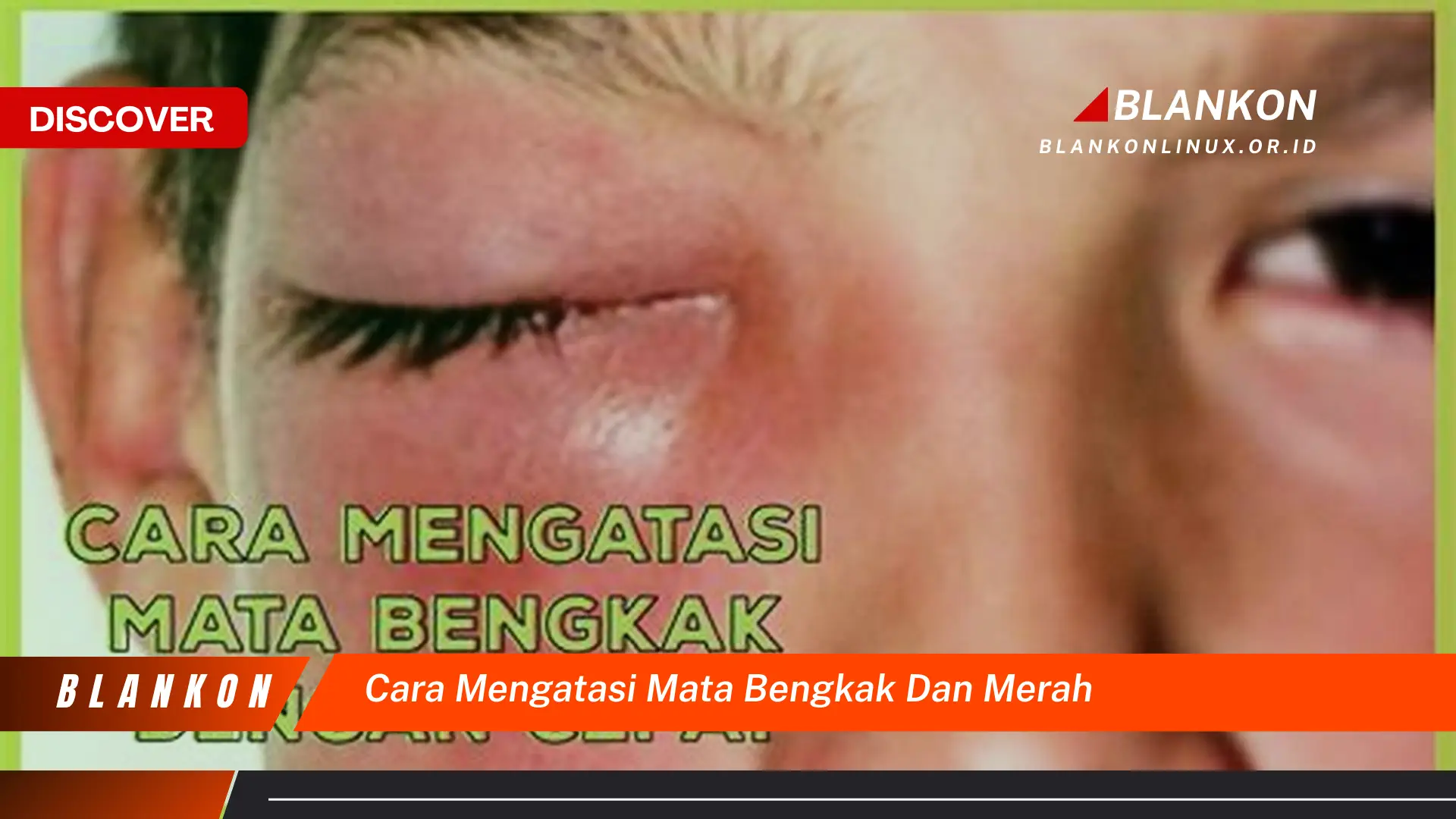 cara mengatasi mata bengkak dan merah