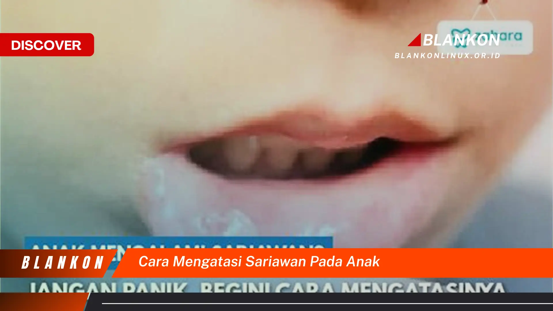 cara mengatasi sariawan pada anak