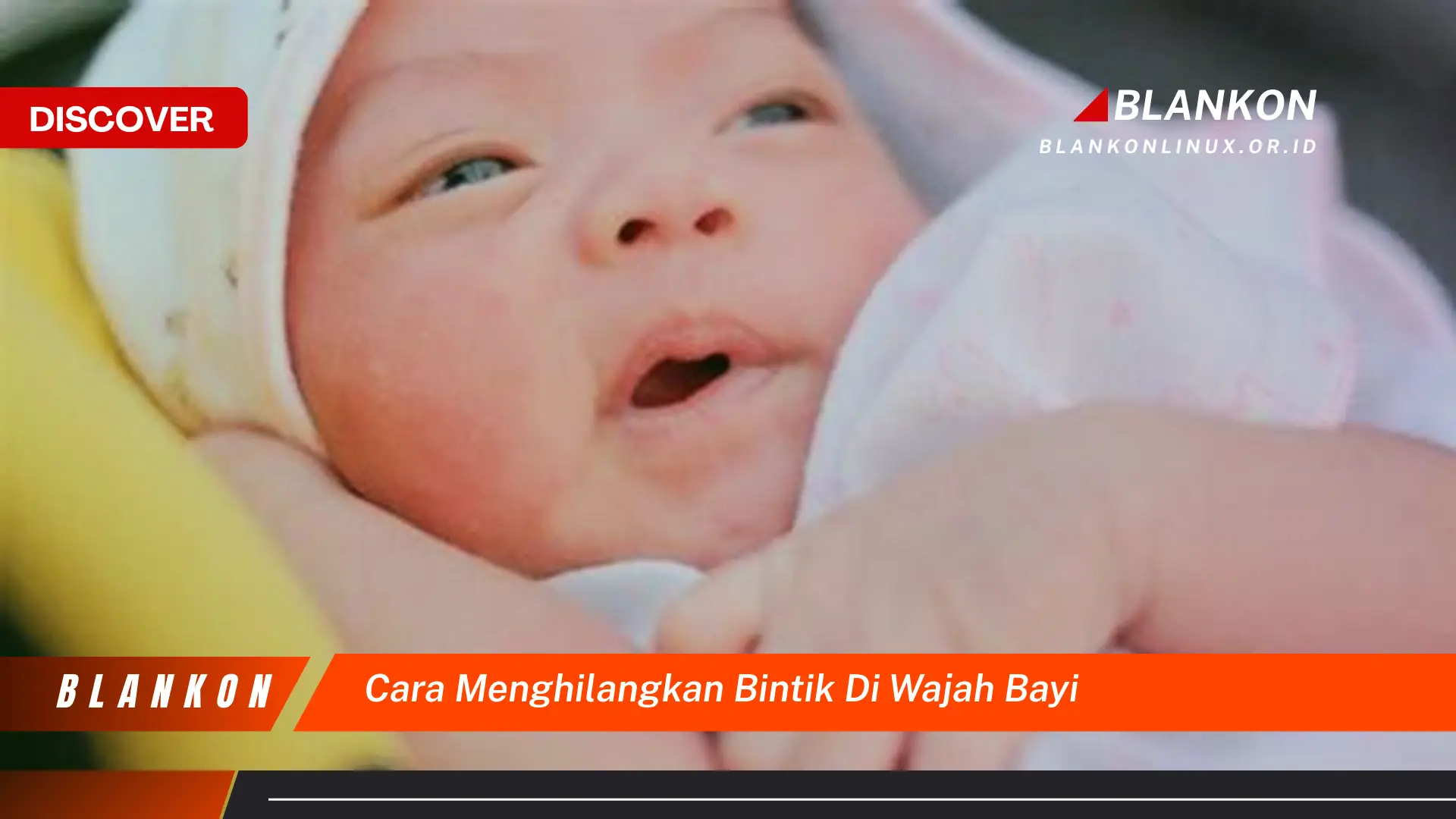 cara menghilangkan bintik di wajah bayi