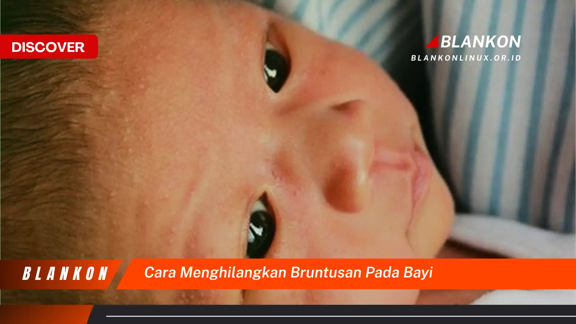 cara menghilangkan bruntusan pada bayi