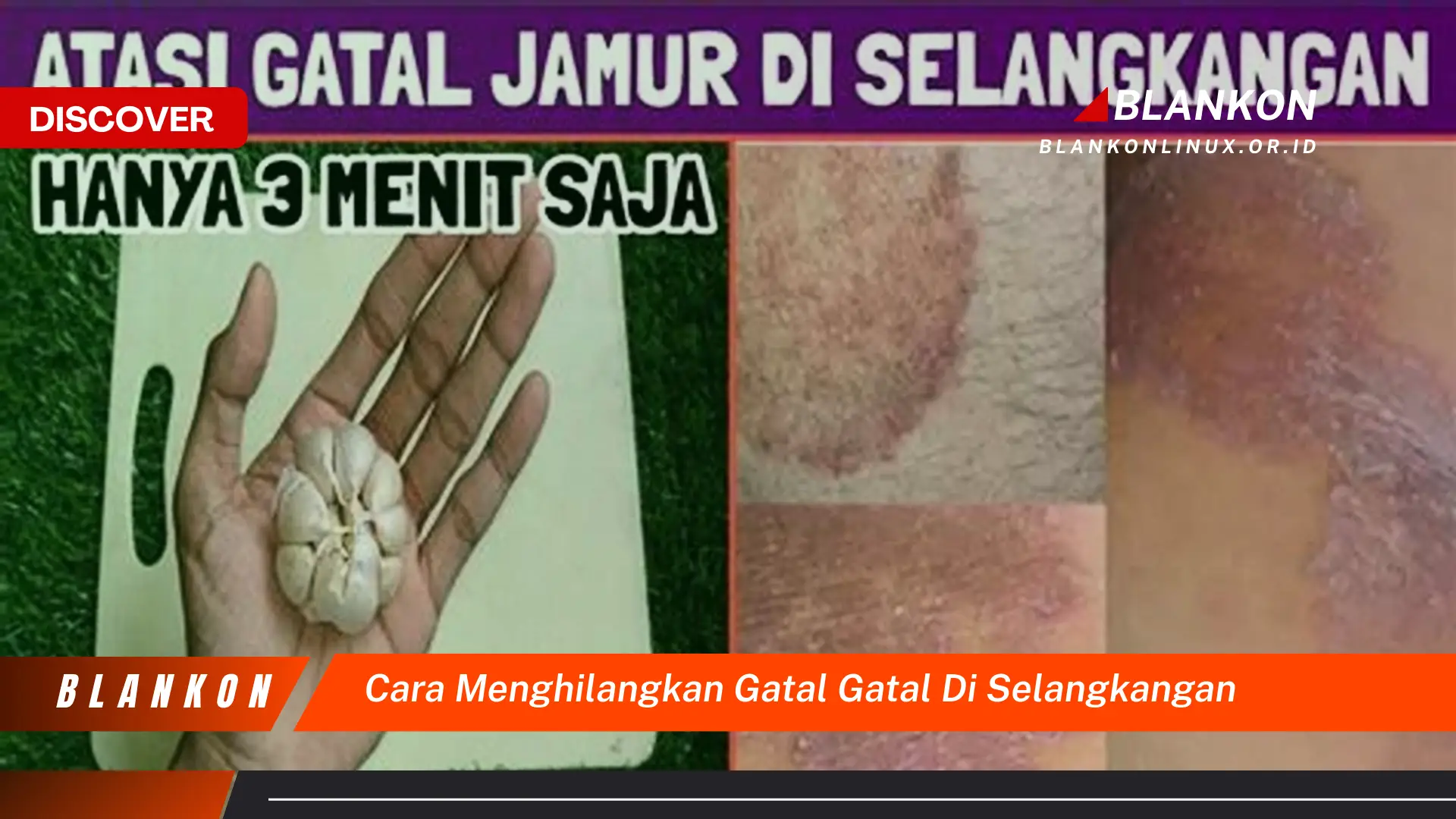 cara menghilangkan gatal gatal di selangkangan