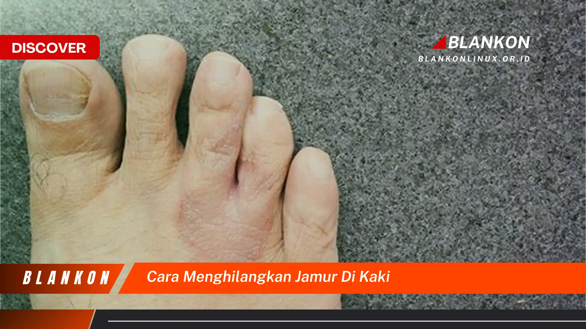 cara menghilangkan jamur di kaki