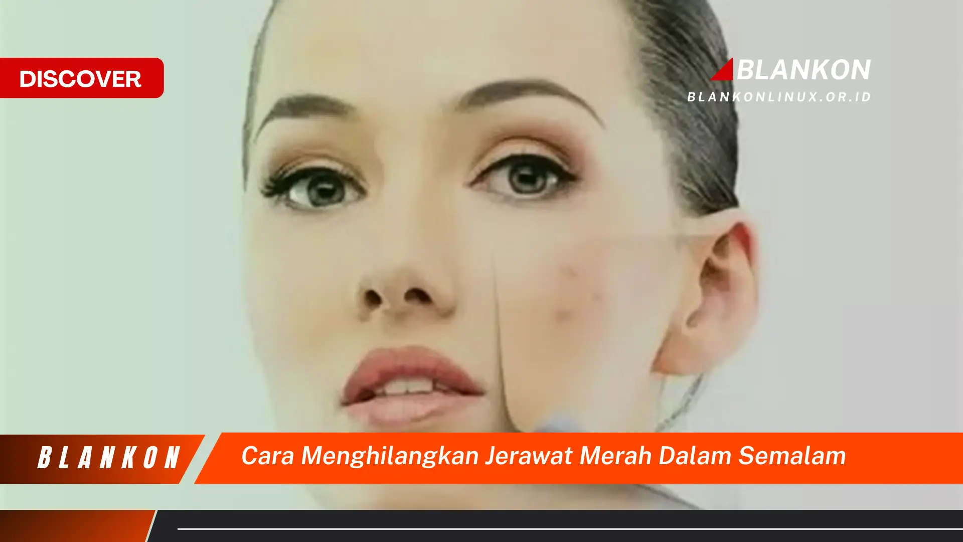 cara menghilangkan jerawat merah dalam semalam