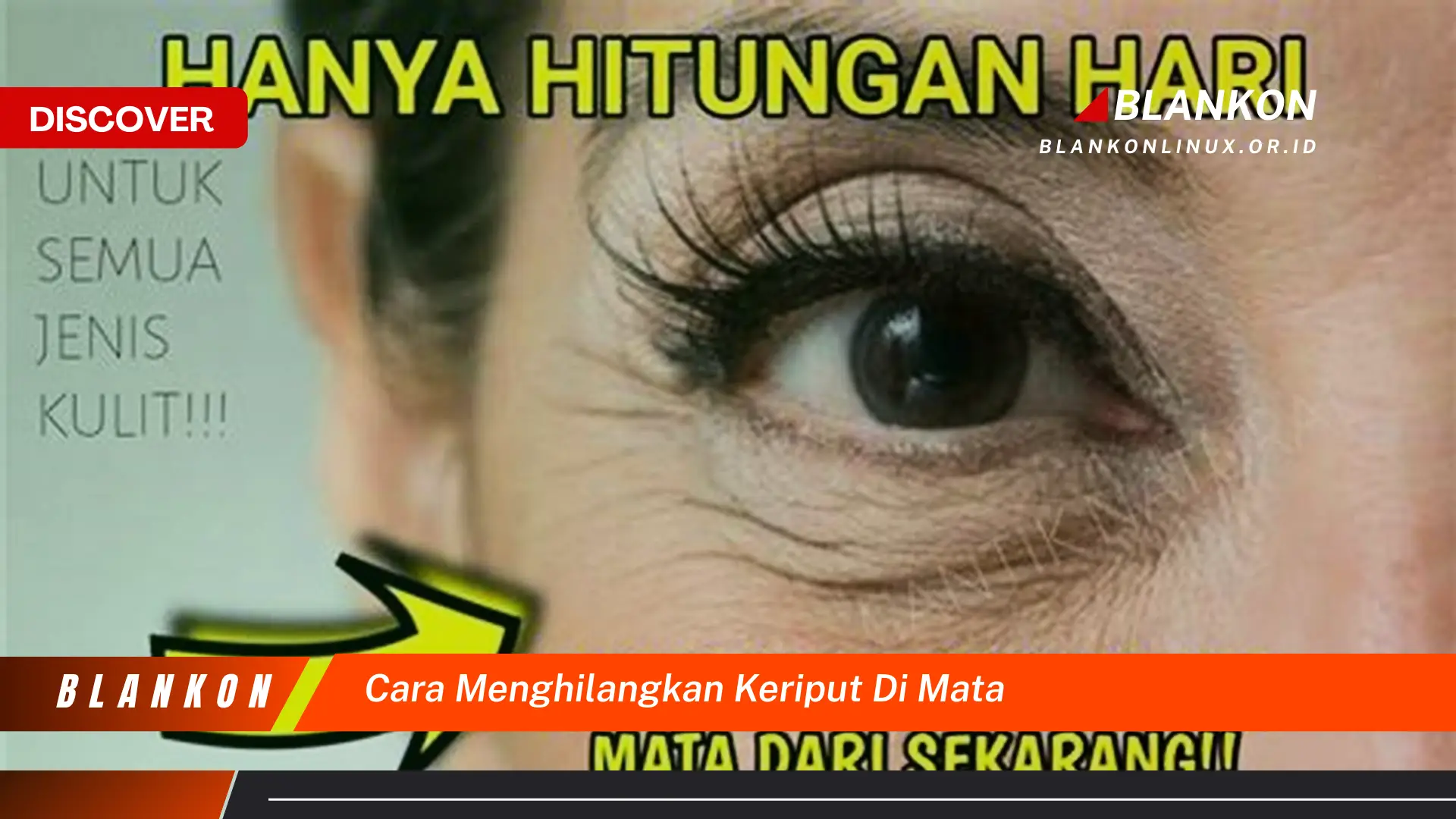 cara menghilangkan keriput di mata