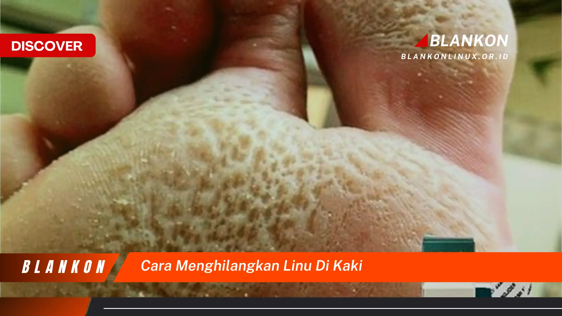 cara menghilangkan linu di kaki cara menghilangkan linu di kaki